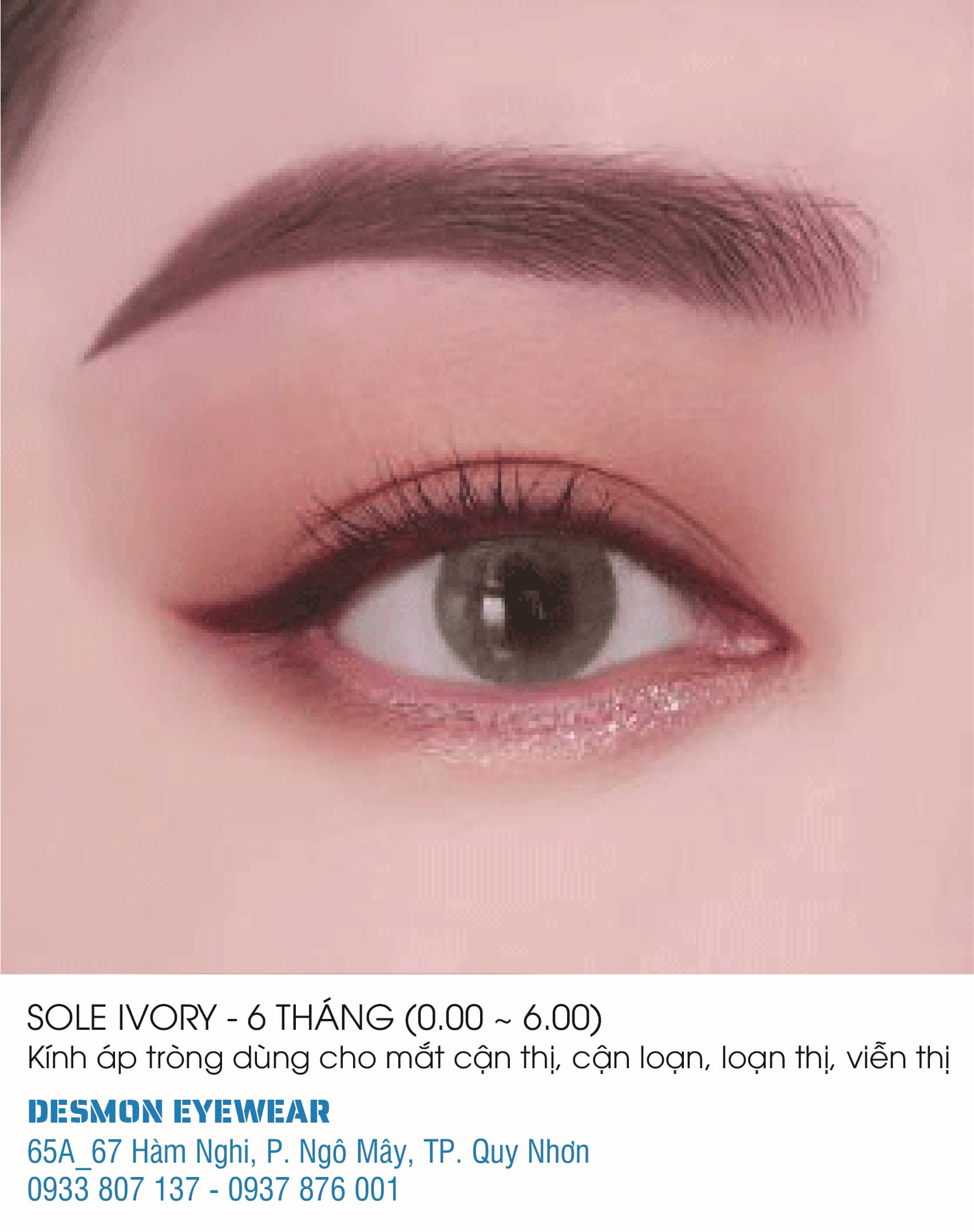 KÍNH ÁP TRÒNG SOLE IVORY - 6 THÁNG